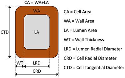 The Physiological Mechanisms Behind the Earlywood-To-Latewood Transition: A Process-Based Modeling Approach